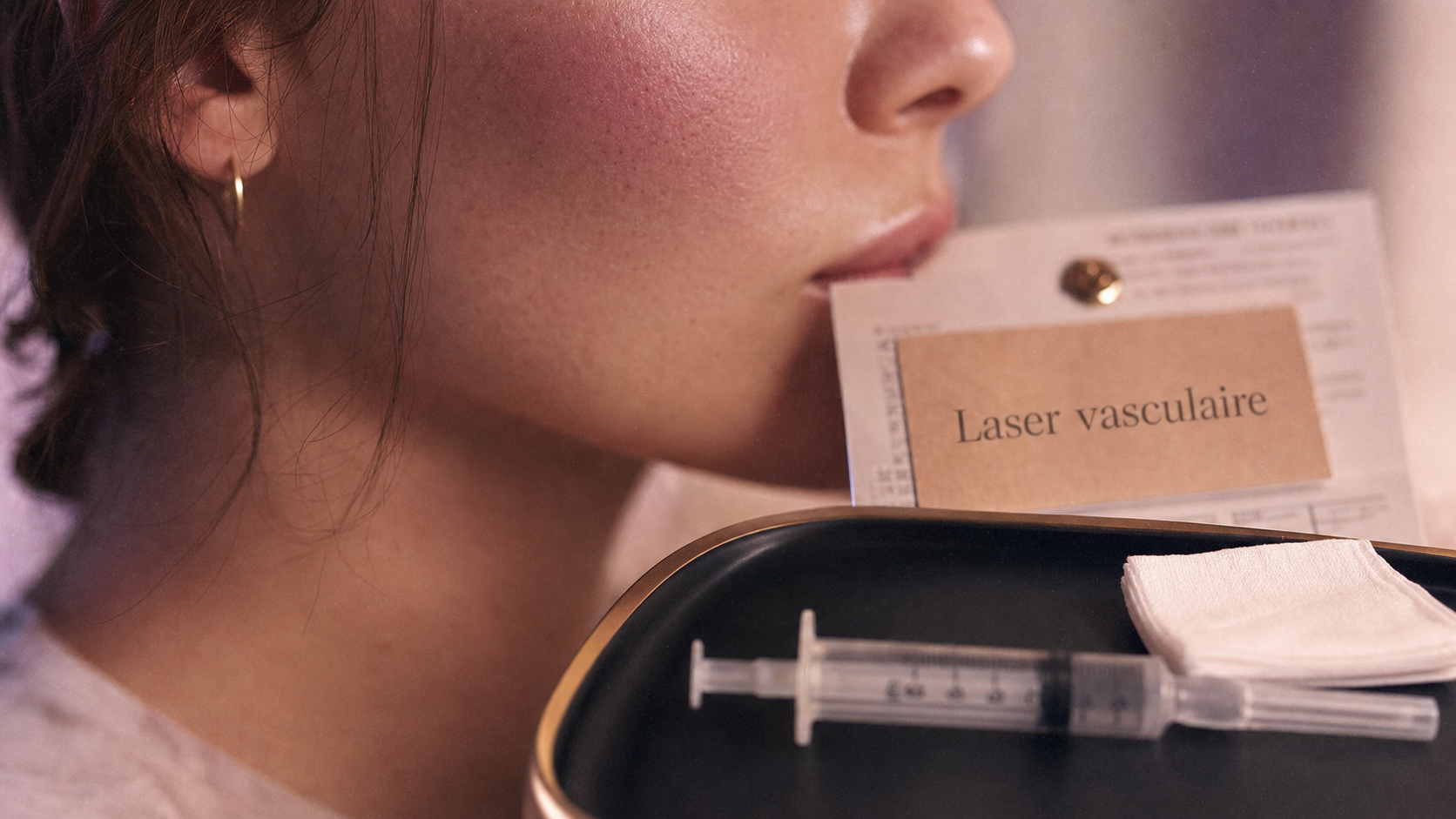 Couperose disparue, laser vasculaire sur le visage