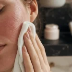 Eczema sur visage : paupières gonflées et peau rouge sèche